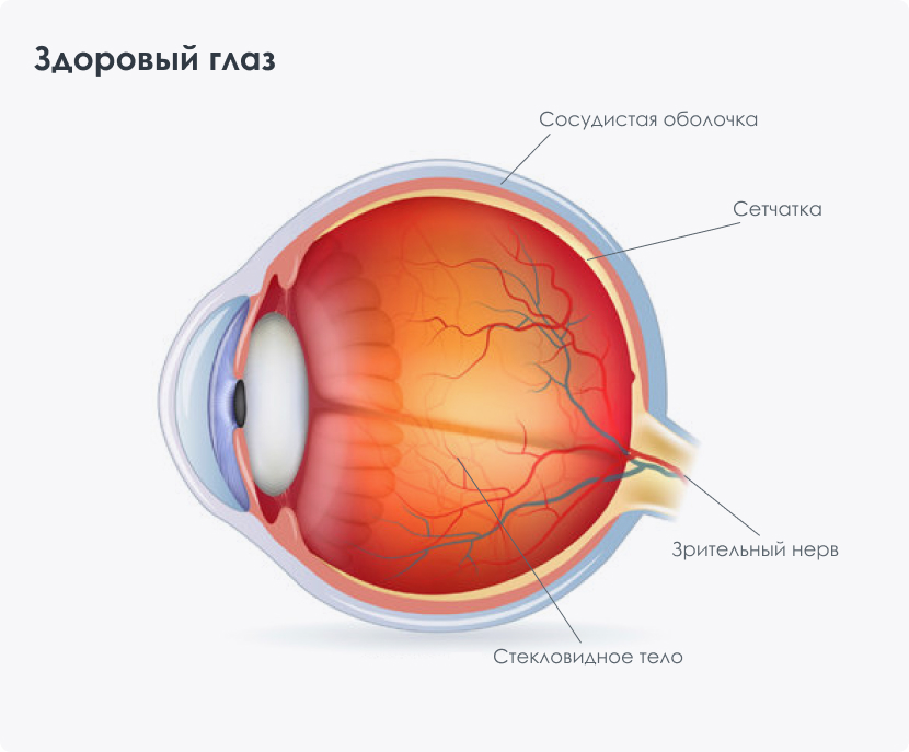 Лечение отслоения сетчатки глаза - цена операции лазером в Санкт-Петербурге